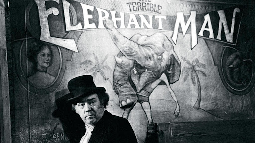 Elephant Man, titre de l'affiche de cirque où était exhibé Joseph Merrick.